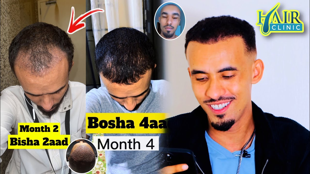 XAQIIQDA MACAAN EE TIMO BEERASHADA (BISHA 1AAD) ILAA (BISHA 5AAD) MAXAA ISKA KEEY BADALAY🫣🤔🤔