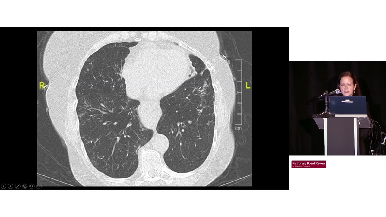 107  Pulmonary Board Review HarvardUpdate Medstudylab.com