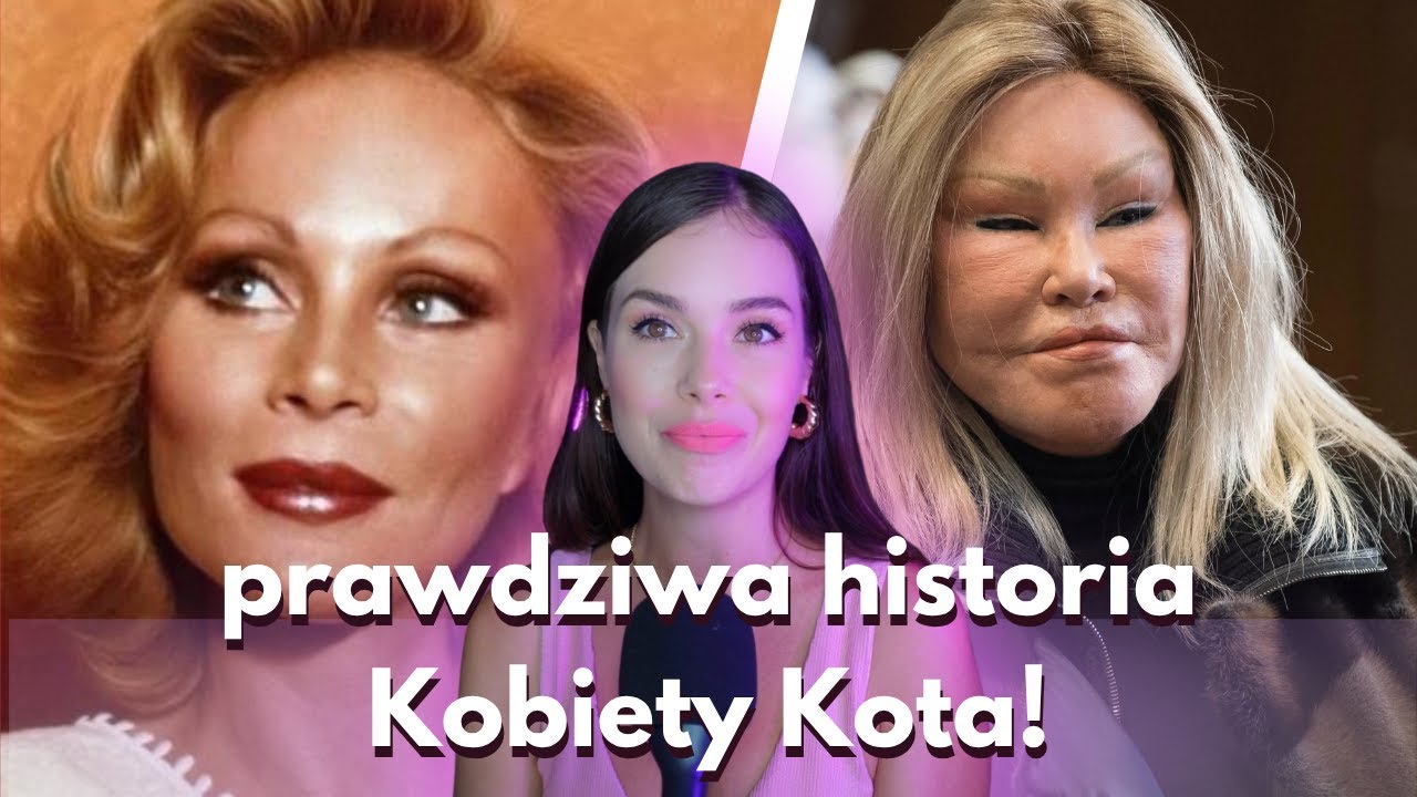 prawdziwa historia Jocelyn Wildenstein! Najdroższy rozwód w historii, prywatne odrzutowce i zdrady!