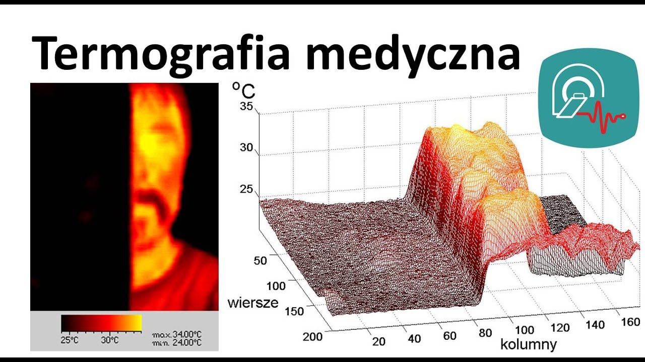 Techniki Obrazowania Medycznego - Termografia medyczna