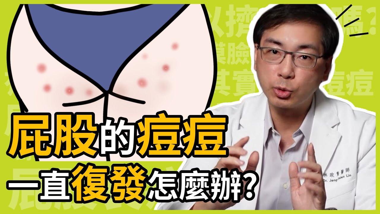 屁股痘痘一直長、一直復發怎麼辦？怎麼保養才不會色素沉澱？皮膚科林政賢醫師美尻保養日記！