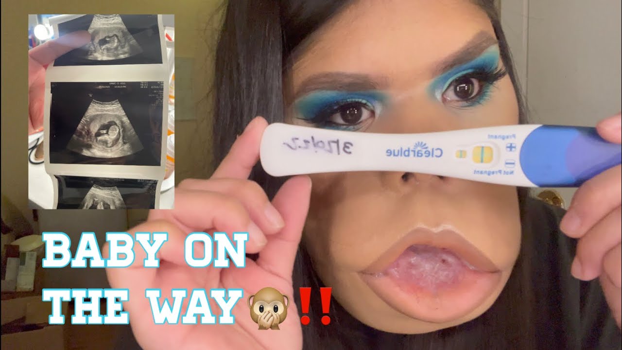 Pregnancy Journey