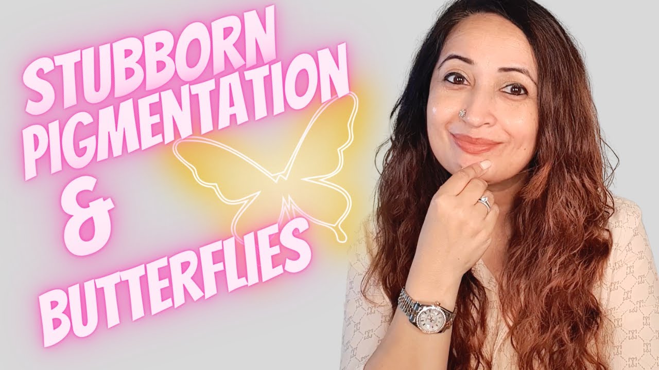 When Best Serums For Hyperpigmentation fail & Skincare Stops Working- Butterfly effect & Your Skin