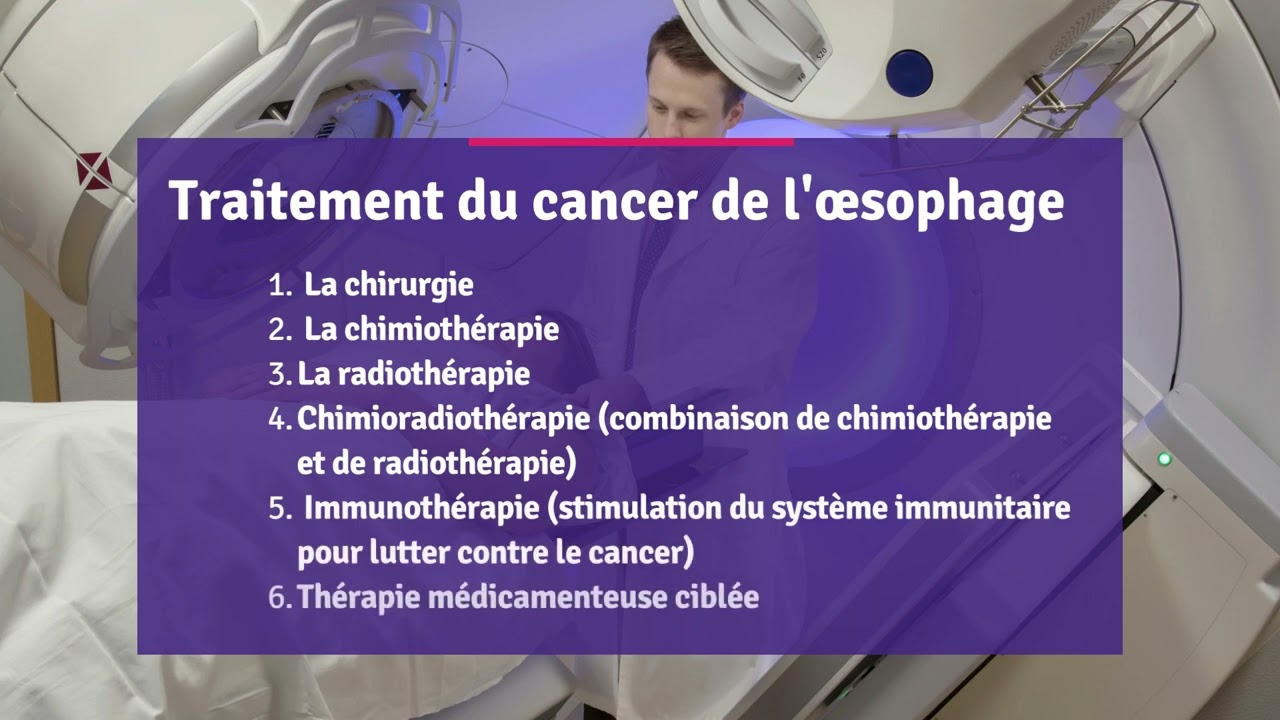 CDHF Talks du cancer de l'&oelig;sophage, partie 5:  Traiter le cancer de l'&oelig;sophage