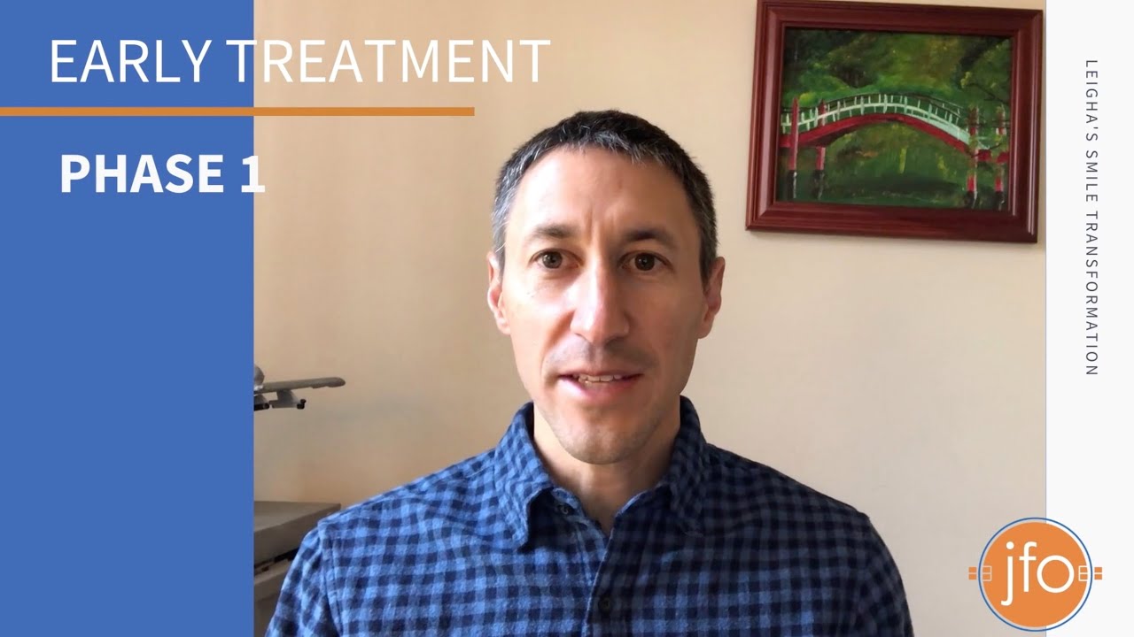 Early Treatment of Ectopic Canines with Space Maintenance & Extraction | Joosse Family Orthodontics