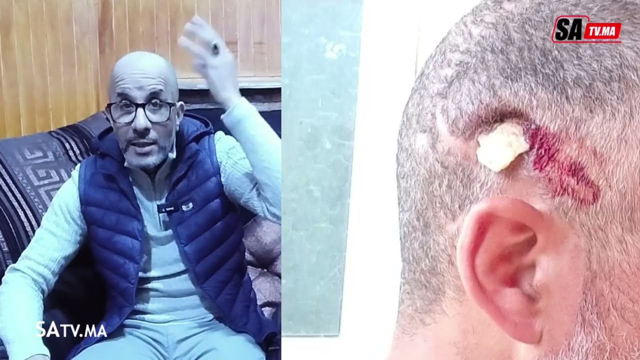  باربي السلامة بغاو اصفيوها ليه ملي خطب ختهم