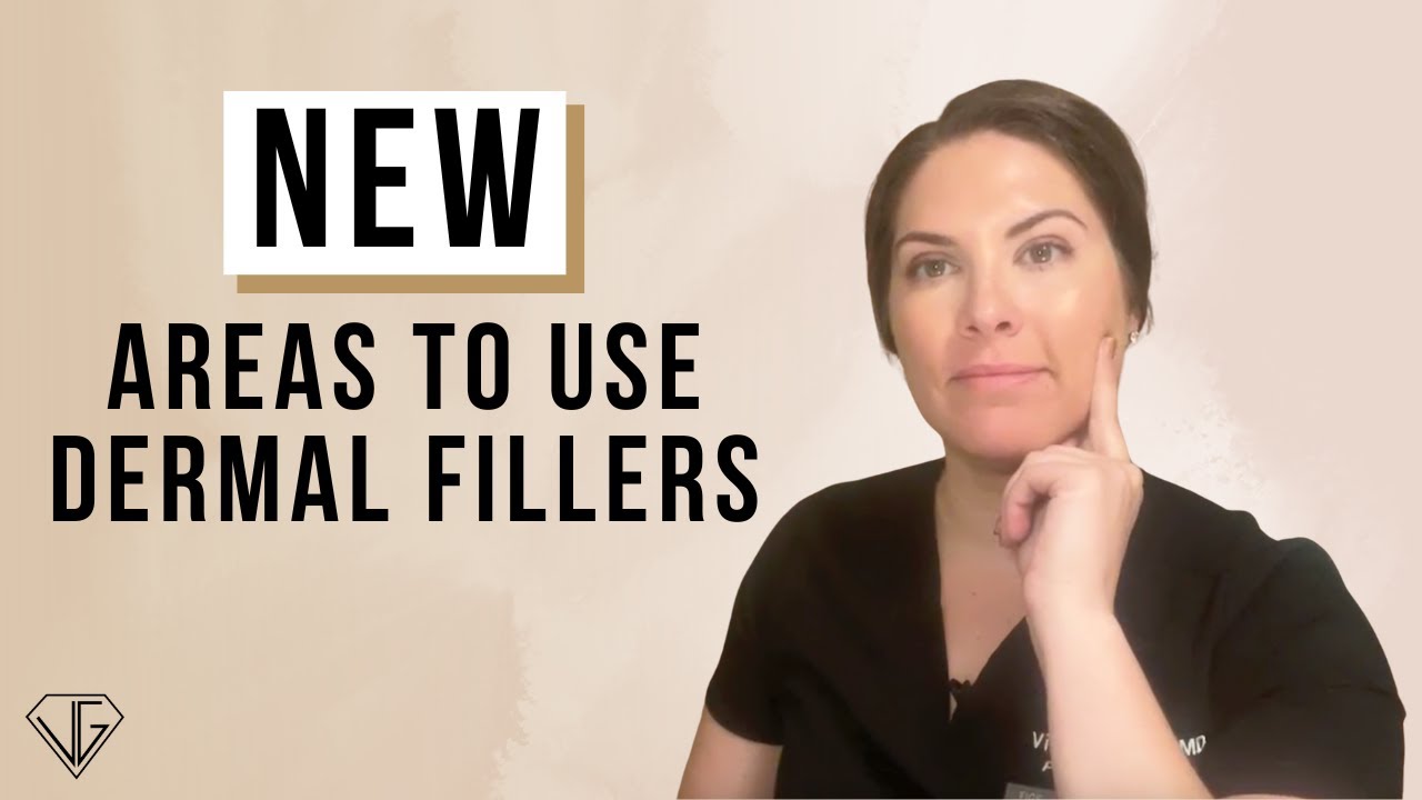 Millennials, This Is How You Can Look 10 Years Younger With Fillers