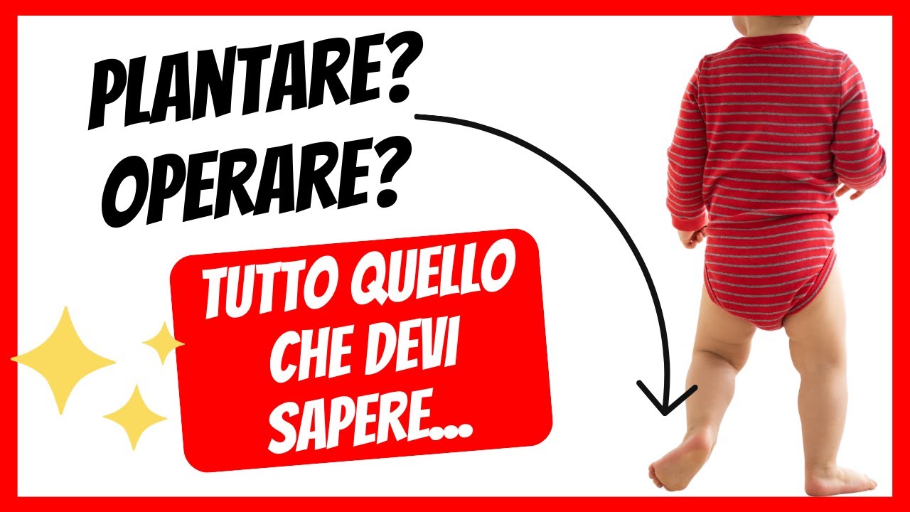 🟢 PIEDE PIATTO e VALGO nei BAMBINI | quando serve il PLANTARE o una OPERAZIONE?