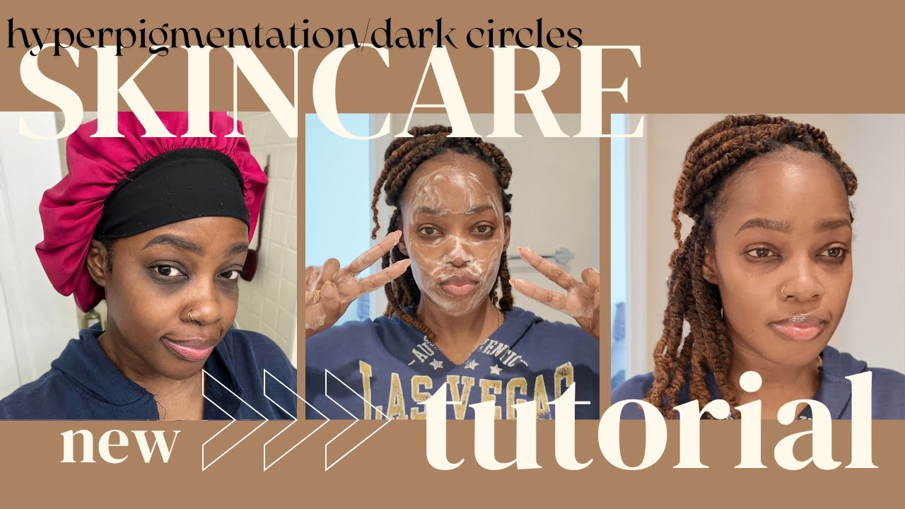 4-WEEK SKIN FLIP! The ONLY Thing That Fixed My Dark Circles + HYPERPIGMENT 😳 YOU WON'T BELIEVE IT ✨