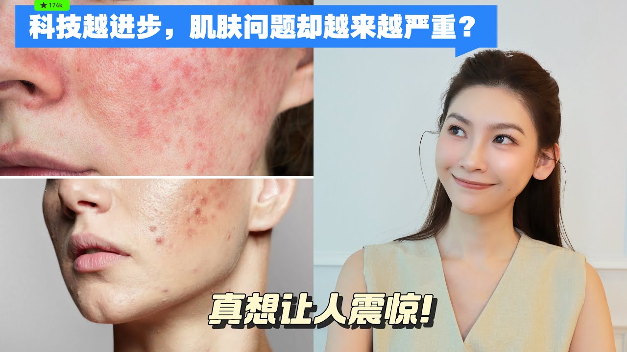为什么科技越来越发达，皮肤问题却越来越？真相让人震惊！