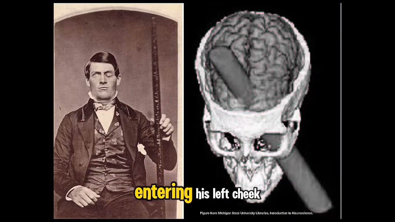 The Curious Case of Phineas Gage