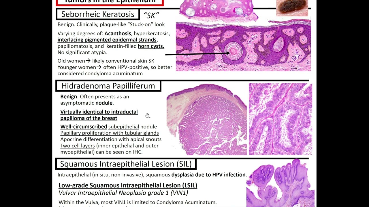 Lesions of the Vulva: Kurt's Notes #pathagonia