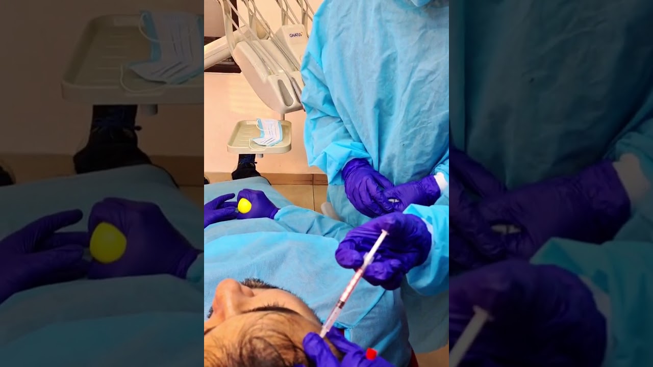Therapeutic Botox in Temporalis