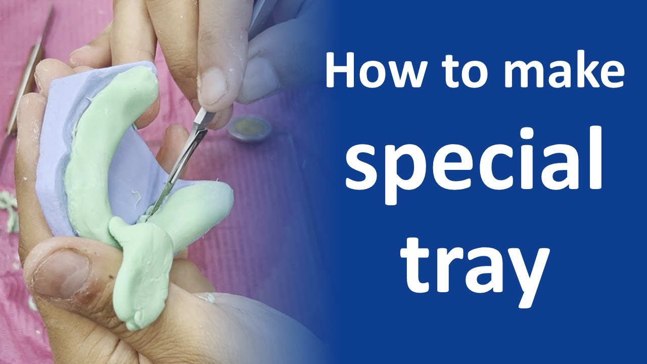 How to make special tray by Dr Mahmoud Zahw
