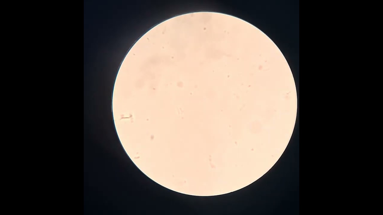 شرح ازاي تظبط عدسات الميكروسكوب 🔬 الجزء الأول 