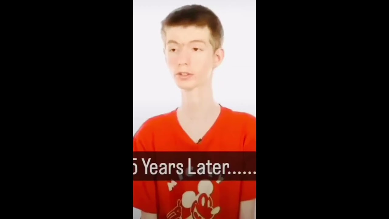 Dad reflexes creates Longneck