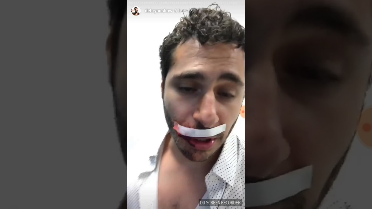 Golpean a debryan show por una mujer y terminan operandolo