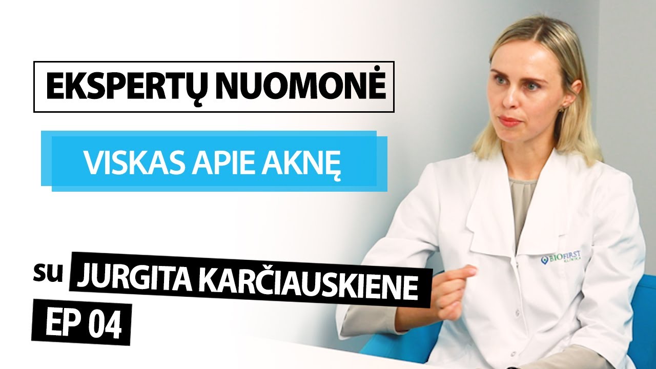 Viskas apie aknę &ndash; EKSPERTŲ NUOMONĖ #4