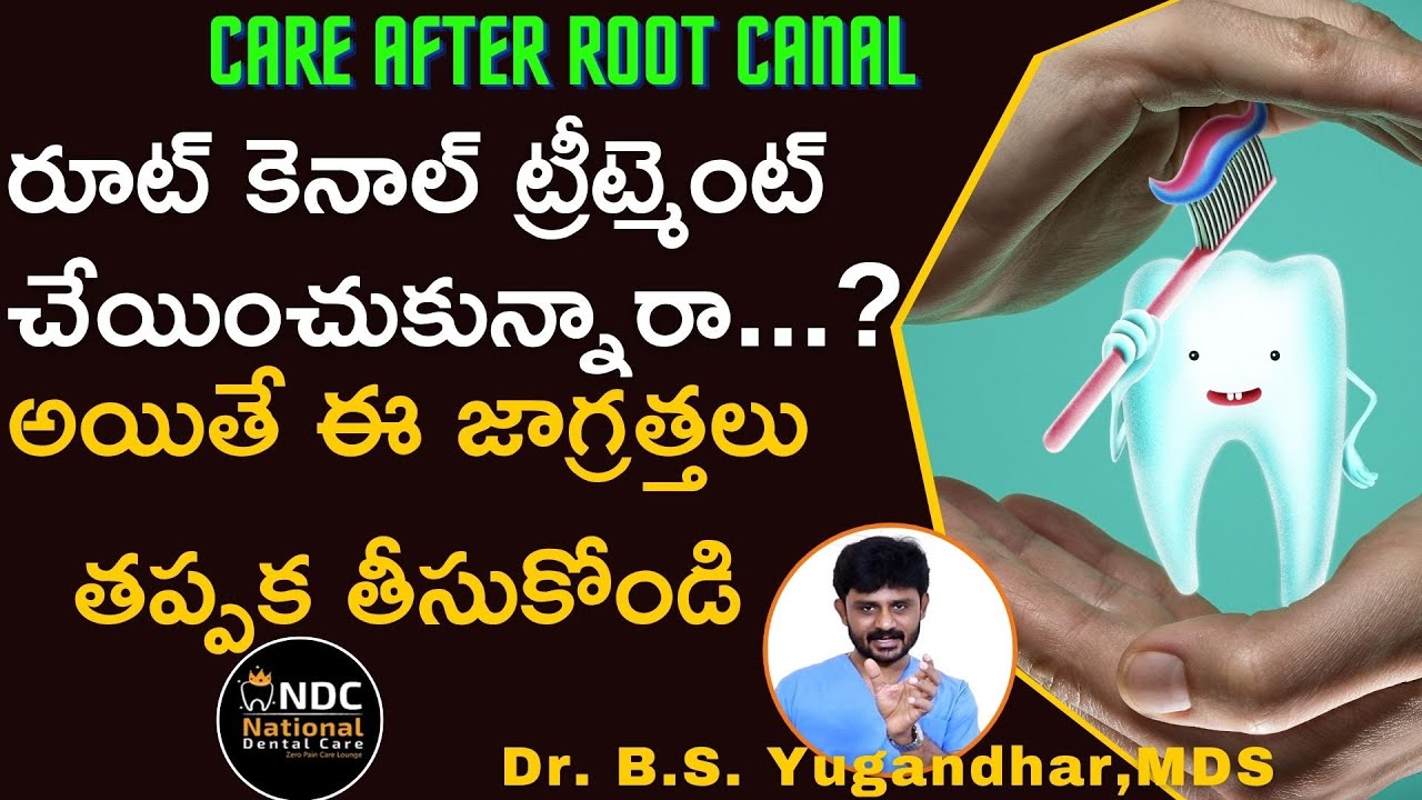 రూట్&zwnj; కెనాల్&zwnj; తర్వాత ఈ జాగ్రత్తలు తప్పనిసరి || Precautions After Root Canal || Dr Yugandhar ||  NDC