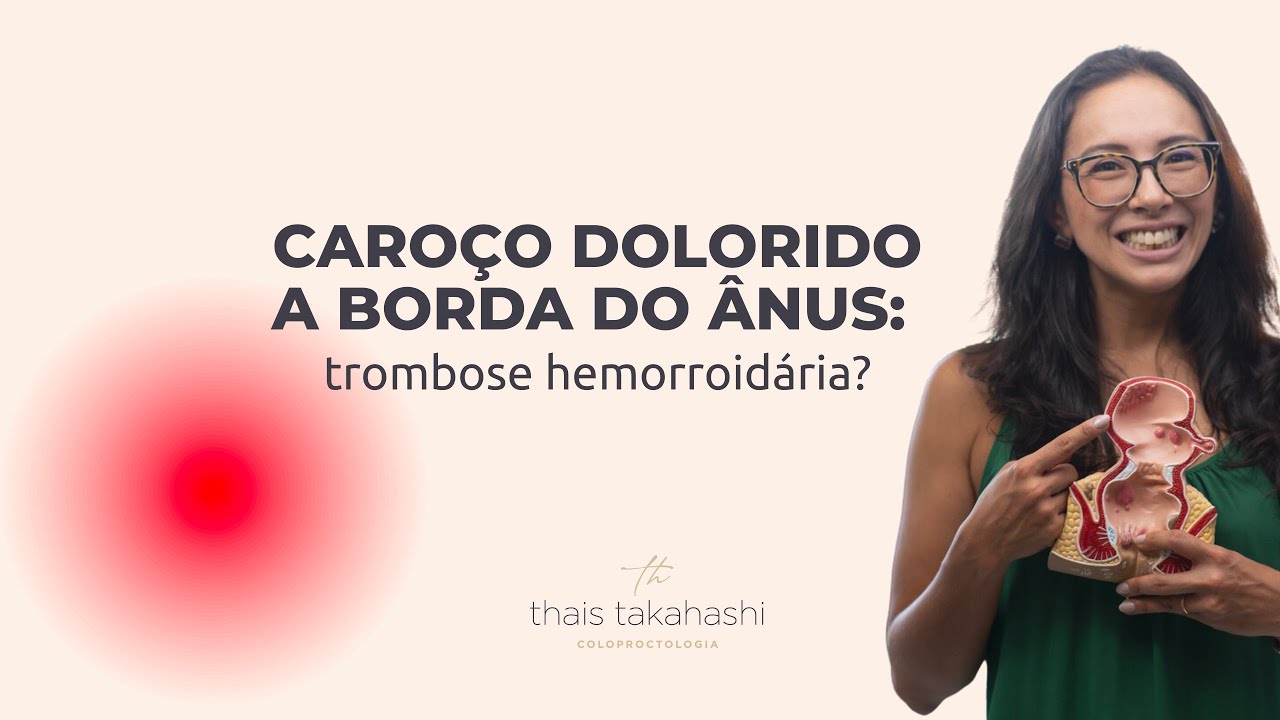 Caroço dolorido a borda do ânus: trombose hemorroidária?