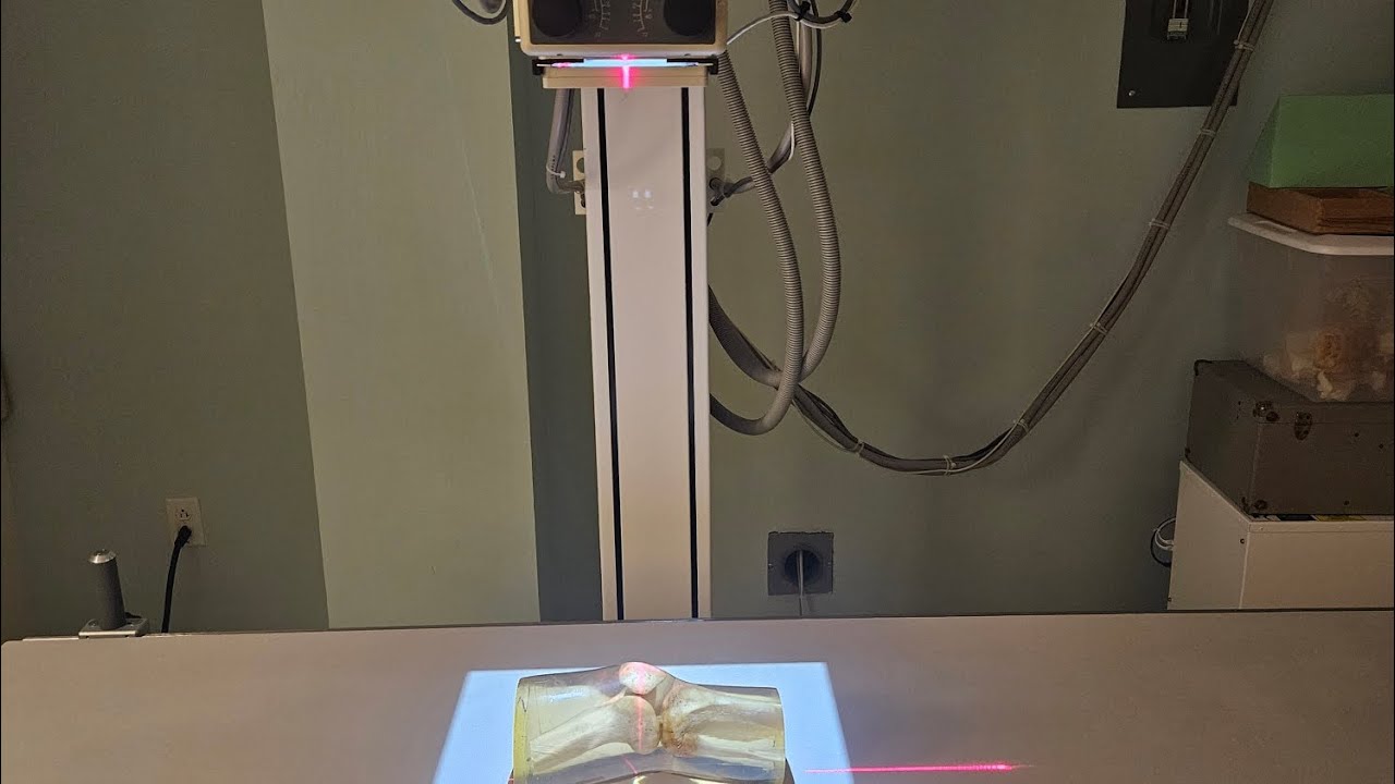 How to center the x-ray tube for Bucky detent