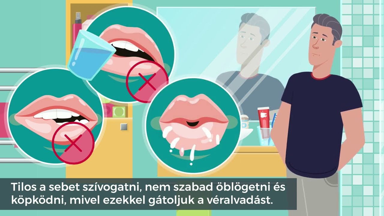 Fogh&uacute;z&aacute;s ut&aacute;n . Mit lehet &eacute;s mit nem?