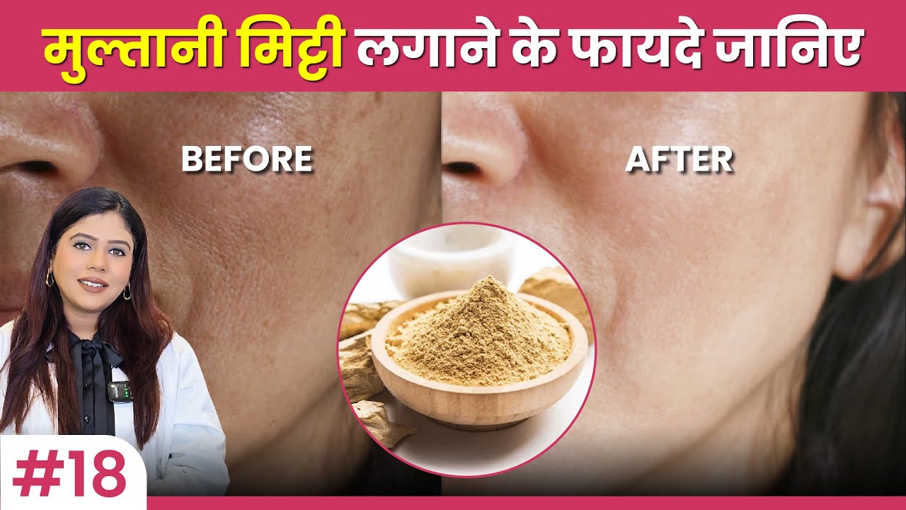 multani mitti face par kaise lagaye | Multani mitti face pack for glowing skin | Dermatologist