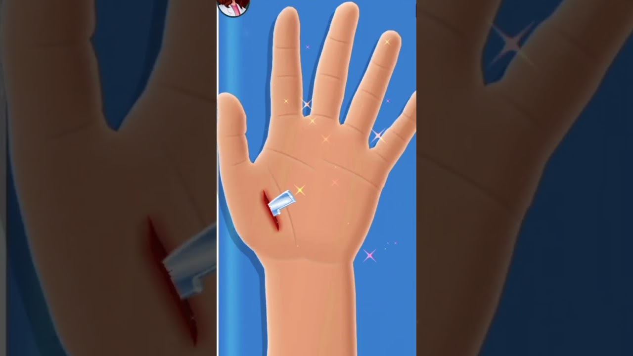 Doctor Surgery Game //Hand surgery//android gameplay
