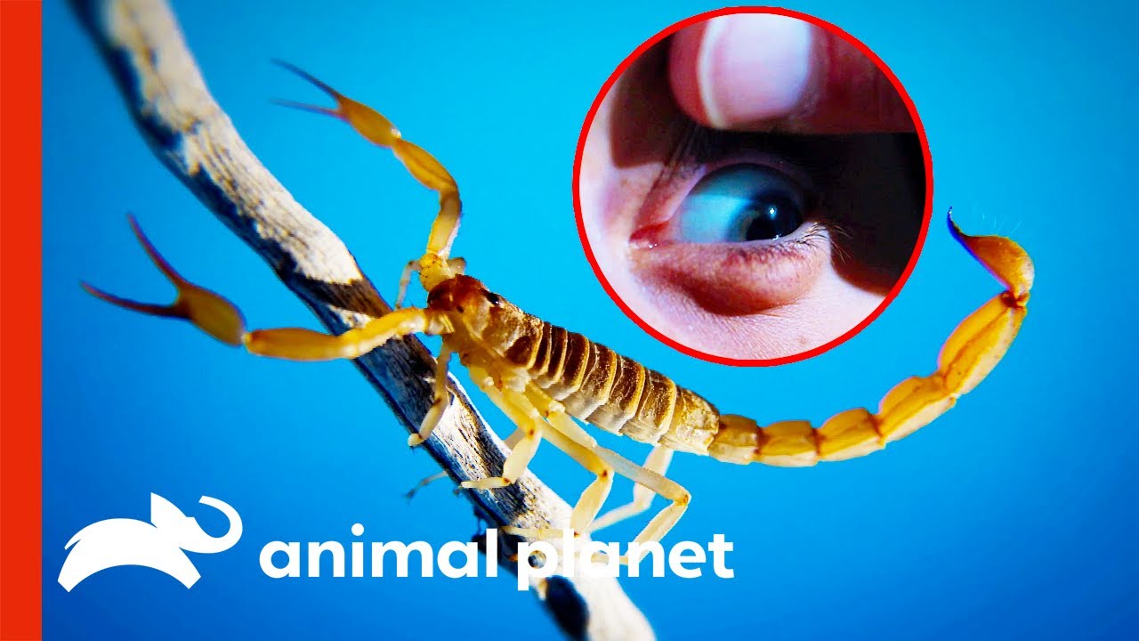 2-Year-Old Stung by Venomous Scorpion | Monsters Inside Me
