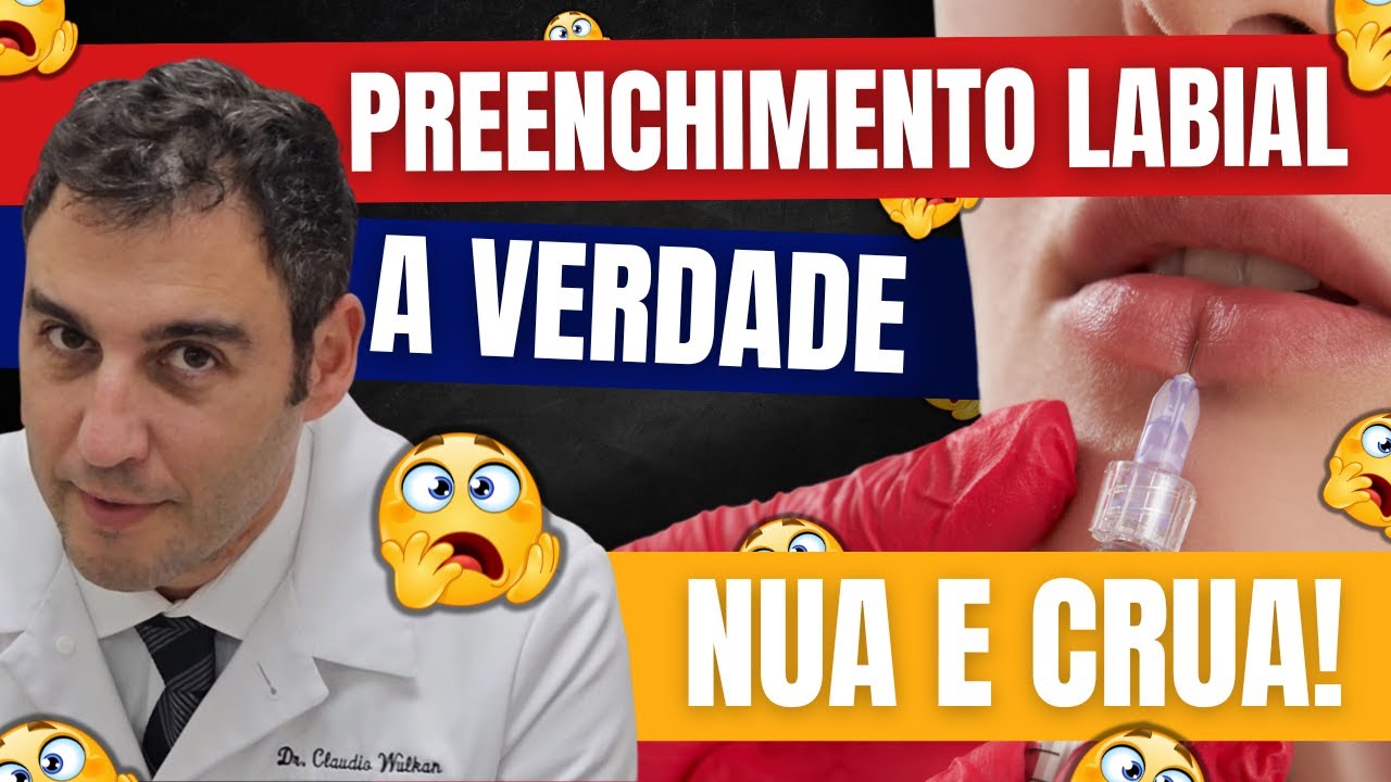 A VERDADE NUA E CRUA sobre Preenchimento Labial! 💋 Vale a pena ou &eacute; cilada?