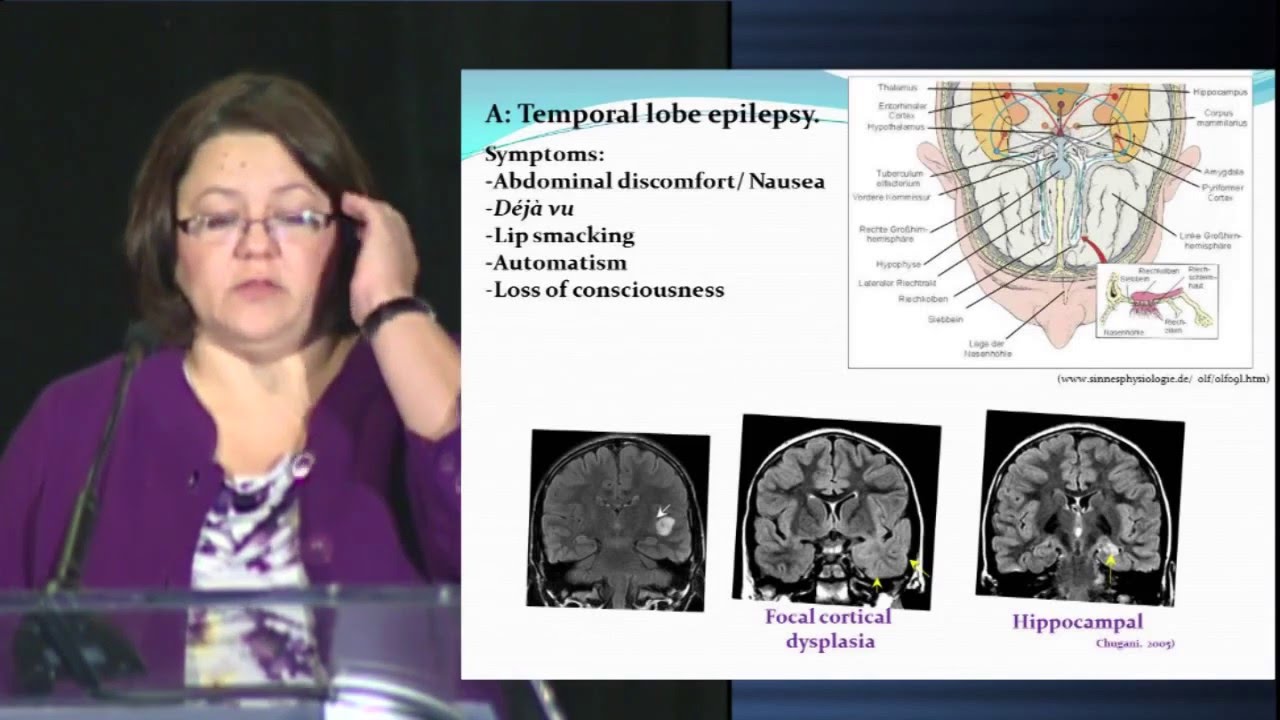 Pediatric Epilepsy: Improving Seizure Control and Quality of Life