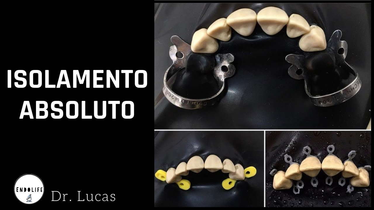 ISOLAMENTO ABSOLUTO EM ENDODONTIA E SUAS MODIFICAÇÕES.