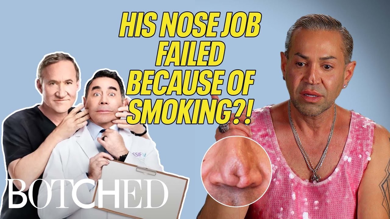 Robert&rsquo;s Nose Job Failed Because He Smoked During Recovery (Before & After) | Botched | E!