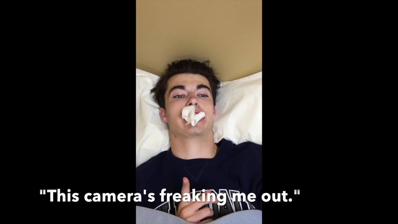 Wisdom Teeth Aftermath