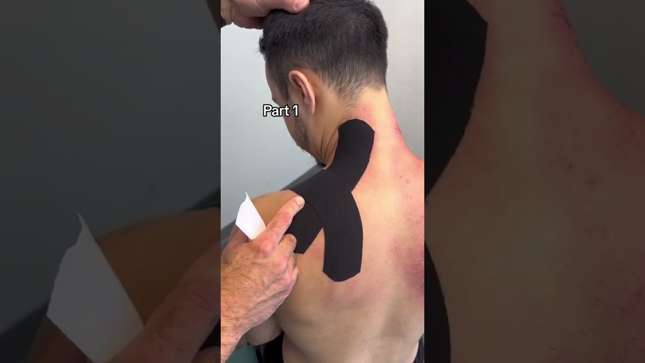 Plastrowanie ramion i szyi #chiropraktyk #rozciąganie #fizjoterapia #chiropraktyka