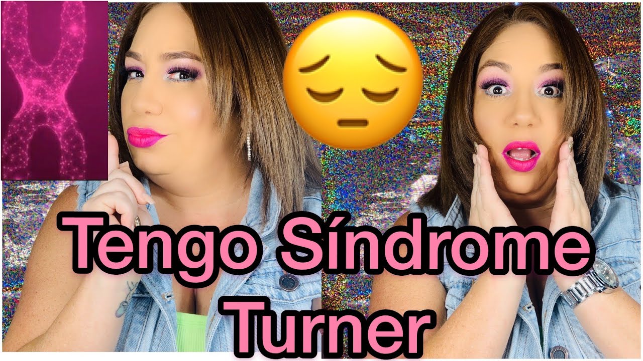 Tengo Síndrome TURNER