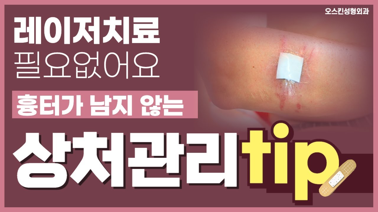 레이저 치료없이 흉터 관리 하는 방법이 궁금하시다면 꼭 확인해보세요!