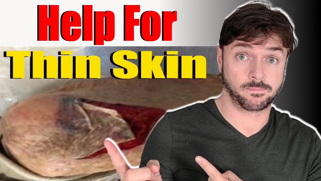 How to TREAT and PREVENT thinning skin | + Thin Skin on Face and Neck | Chris Gibson