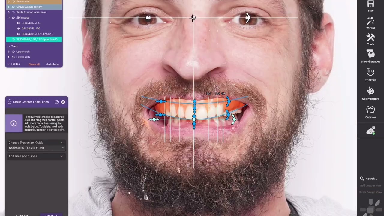 Now this is Digital Dentistry!
