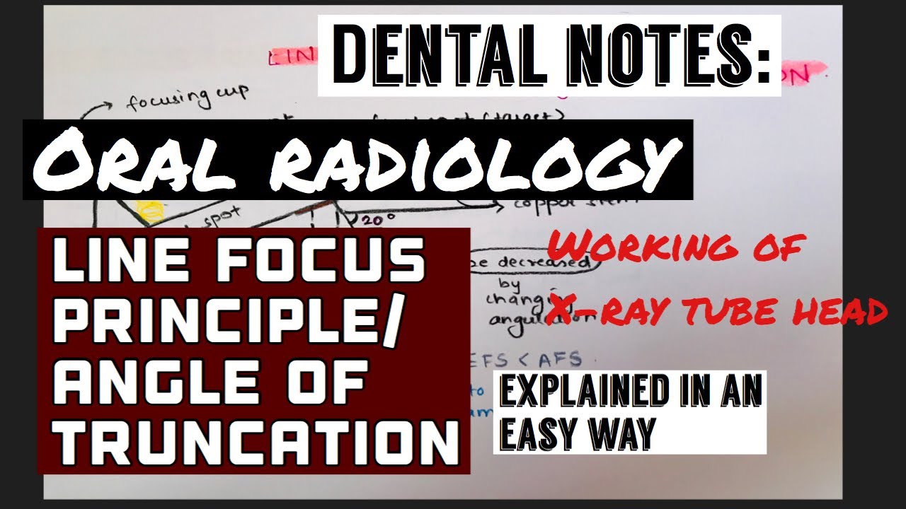 LINE FOCUS PRINCIPLE/ ANGLE OF TRUNCATION || ORAL RADIOLOGY || WORKING OF X-RAY TUBE HEAD(made easy)