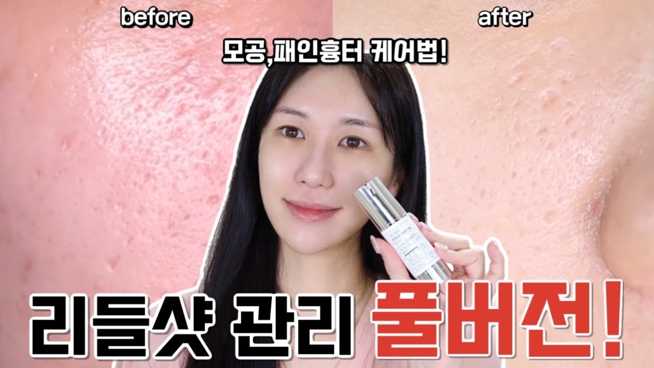 리들샷 관리 풀버전‼️모공,패인흉터 옅어지게 만드는 리들샷700 관리법✨틀어놓고 따라하세요🤗/피부 좋아지는 스킨케어 조합/다음날 관리법까지/로맨틱민서