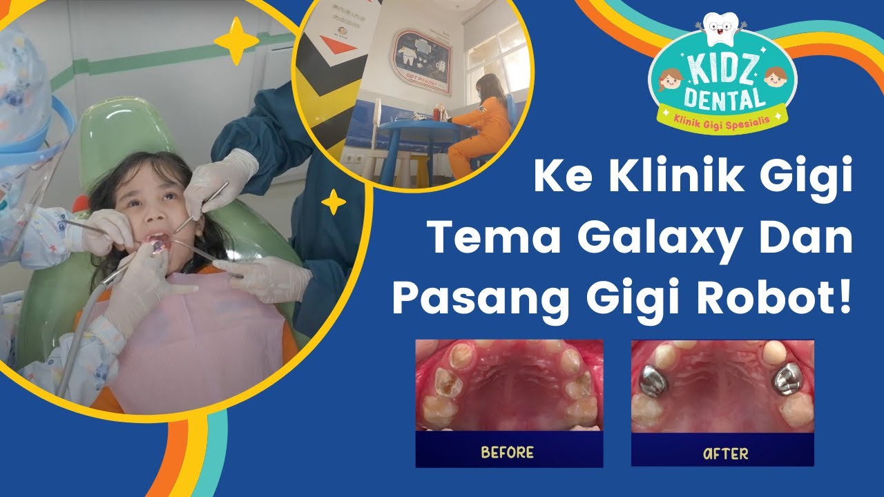 KENAPA TAMBALAN SERING LEPAS? METAL CROWN alias GIGI ROBOT LEBIH AWET?