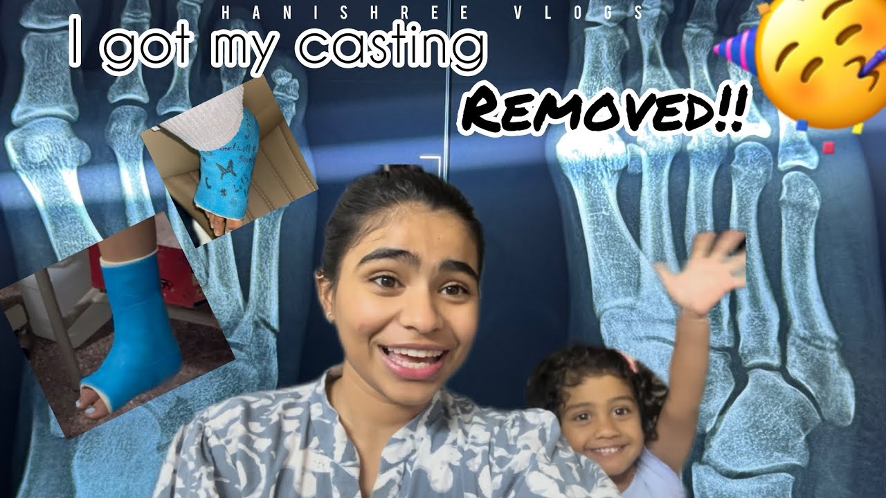 Finally I got rid of my casting 🥳!!#hanishree_vlogs #legfracture #kannadavlogger #youtuber 