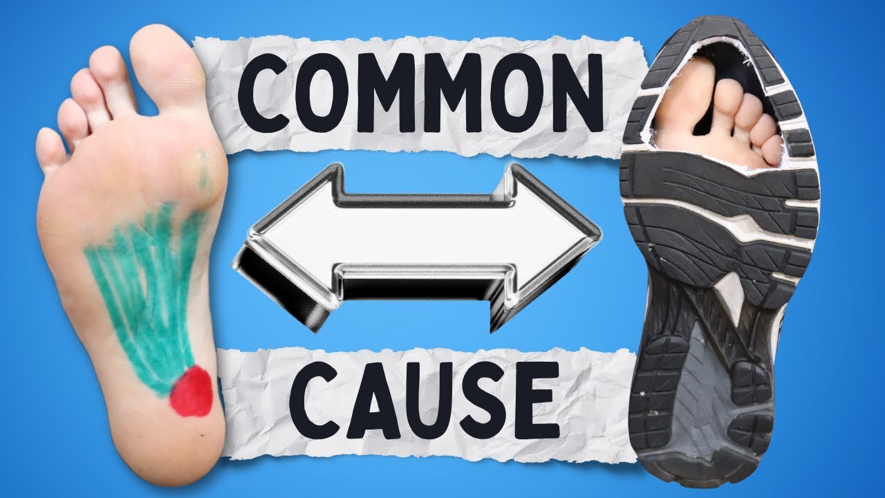 Fix Foot Pain & Plantar Fasciitis (All You Need to Know)
