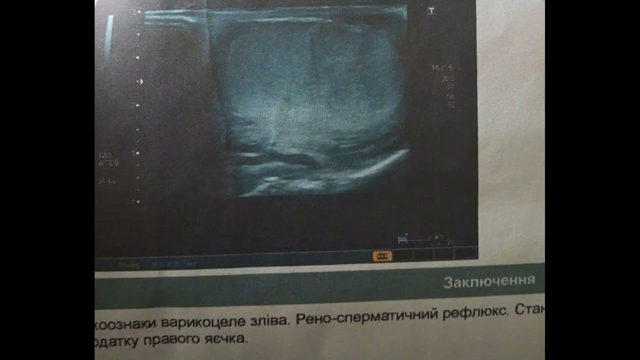 Fighter maksim - завтра я лягу на стол