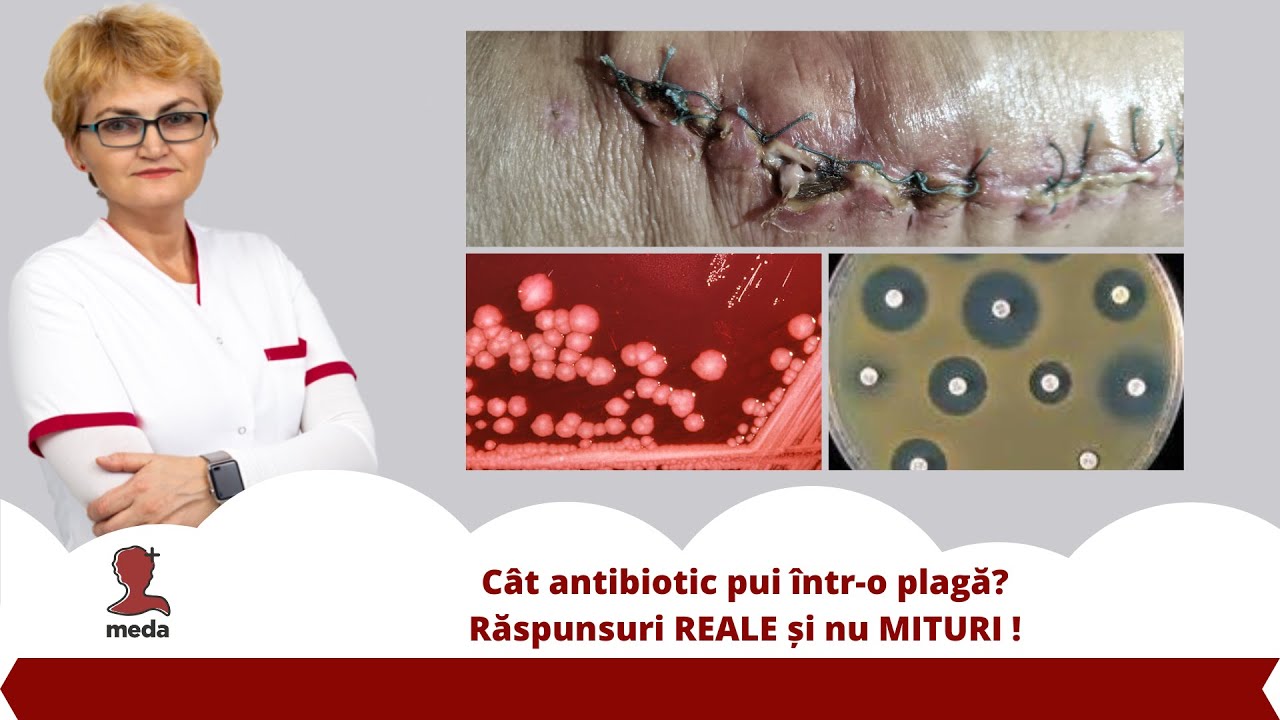 Cât antibiotic pui într o plagă? Răspunsuri REALE și nu MITURI ! #medatalos #programulvocea