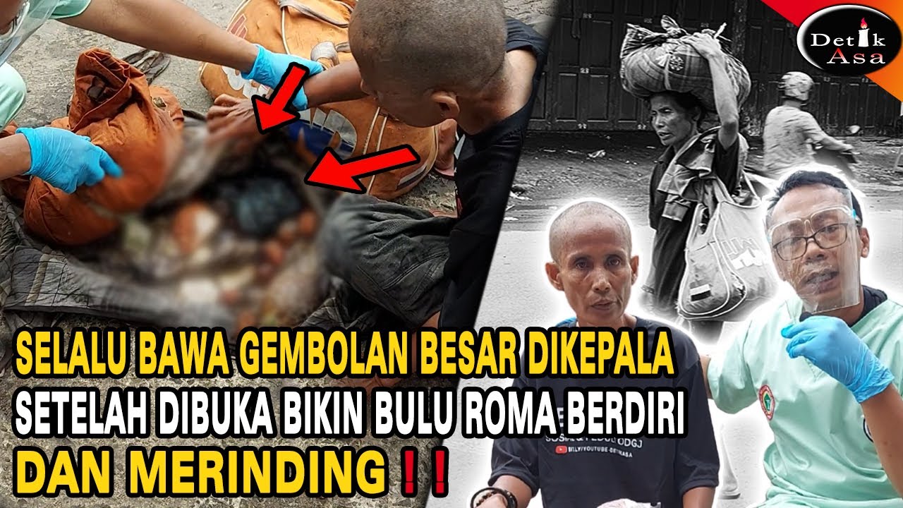 AWALNYA DISANGKA WARIOR TERNYATA OD*J INI WANITA TULEN - Detik Asa
