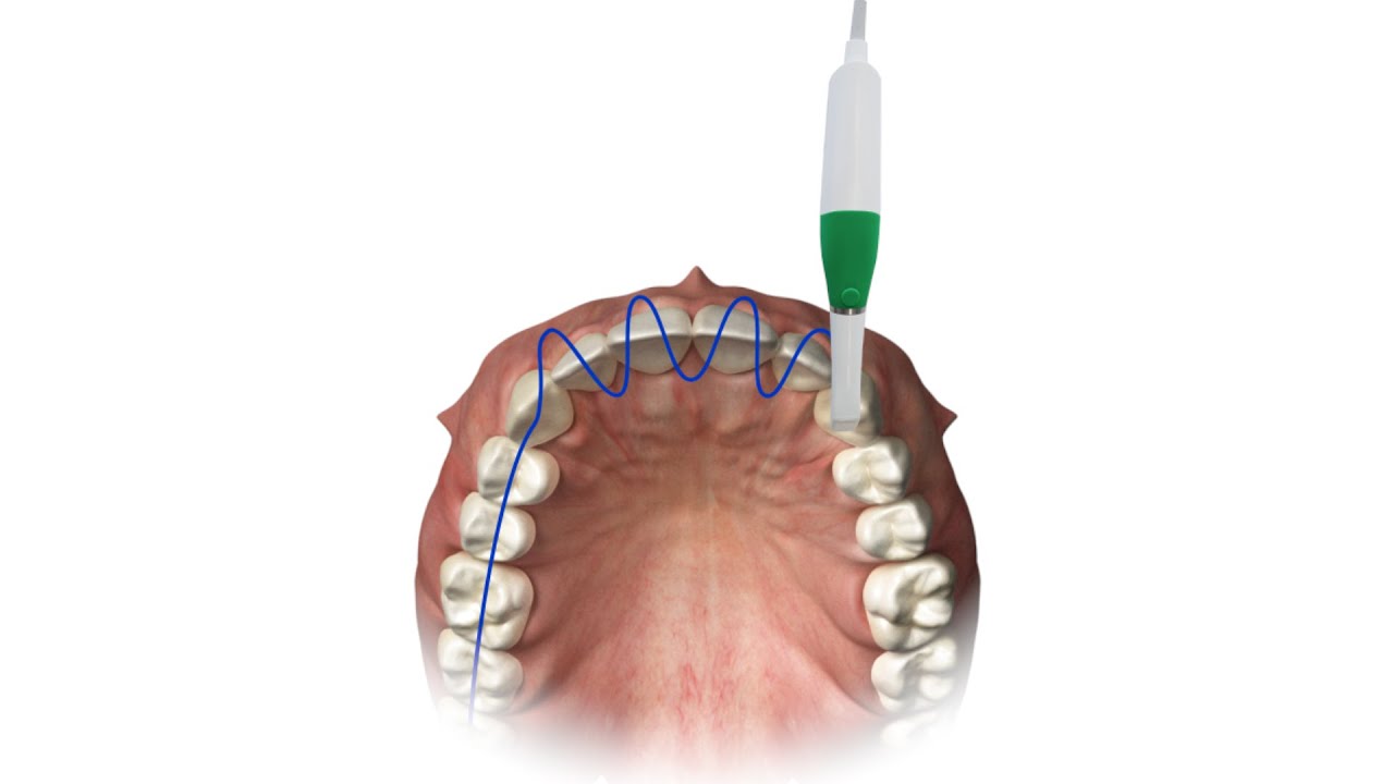 Full arch scan pattern for Planmeca Emerald™ scanners
