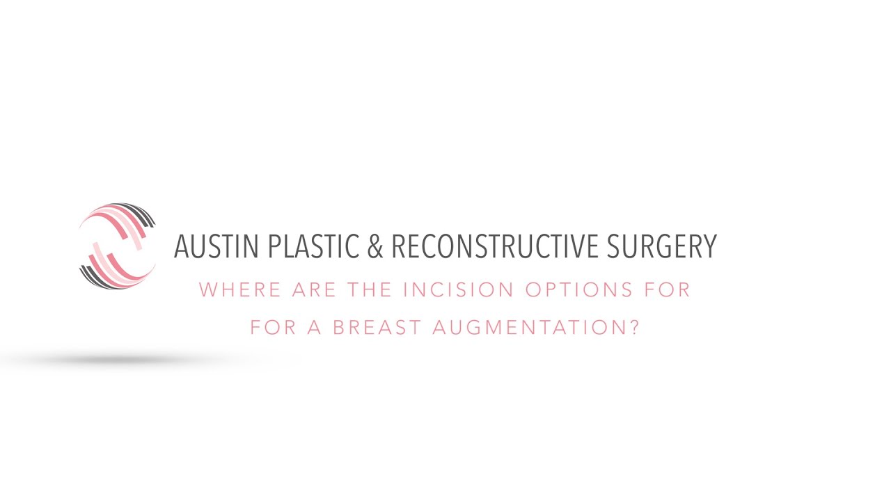 Where are the Incision Options for a Breast Augmentation?