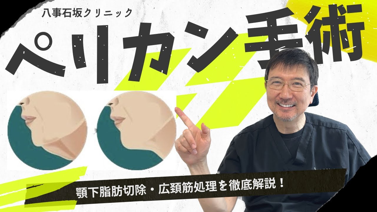 若見え【ペリカン手術】顎下脂肪切除＋広頚筋縛り徹底解説【八事石坂クリニック】